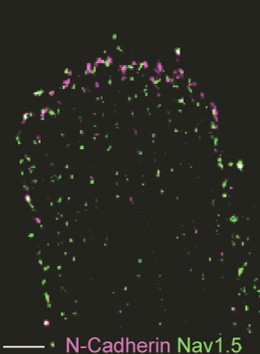 project2 Afbeelding18